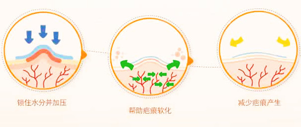 疤痕修复医院哪里好-北京八大处 疤痕修复医院哪里好-北京八大处