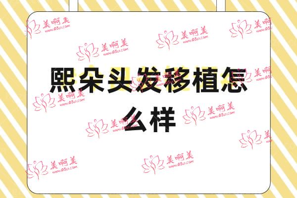 熙朵头发移植怎么样 熙朵头发移植怎么样