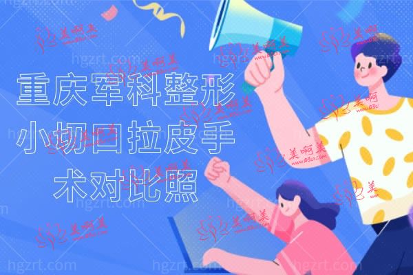 重庆军科整形小切口拉皮手术对比照 重庆军科整形小切口拉皮手术对比照