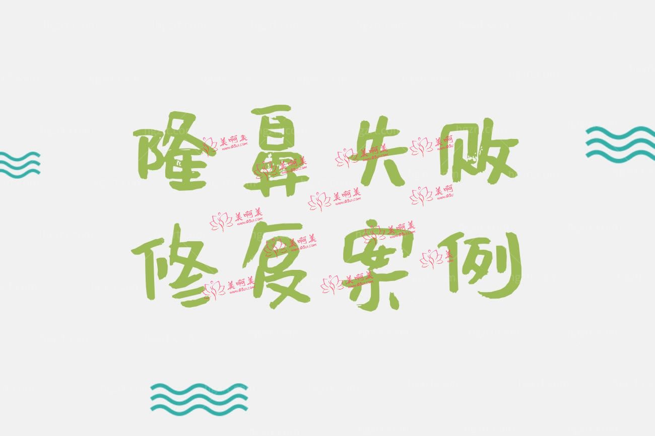 隆鼻失败修复病例.jpg 隆鼻失败修复病例.jpg