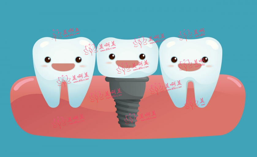 广州口腔医院种植牙、正畸等 的收费情况是怎样的？