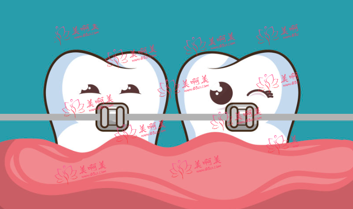 广州口腔医院种植牙、正畸等 的收费情况是怎样的？