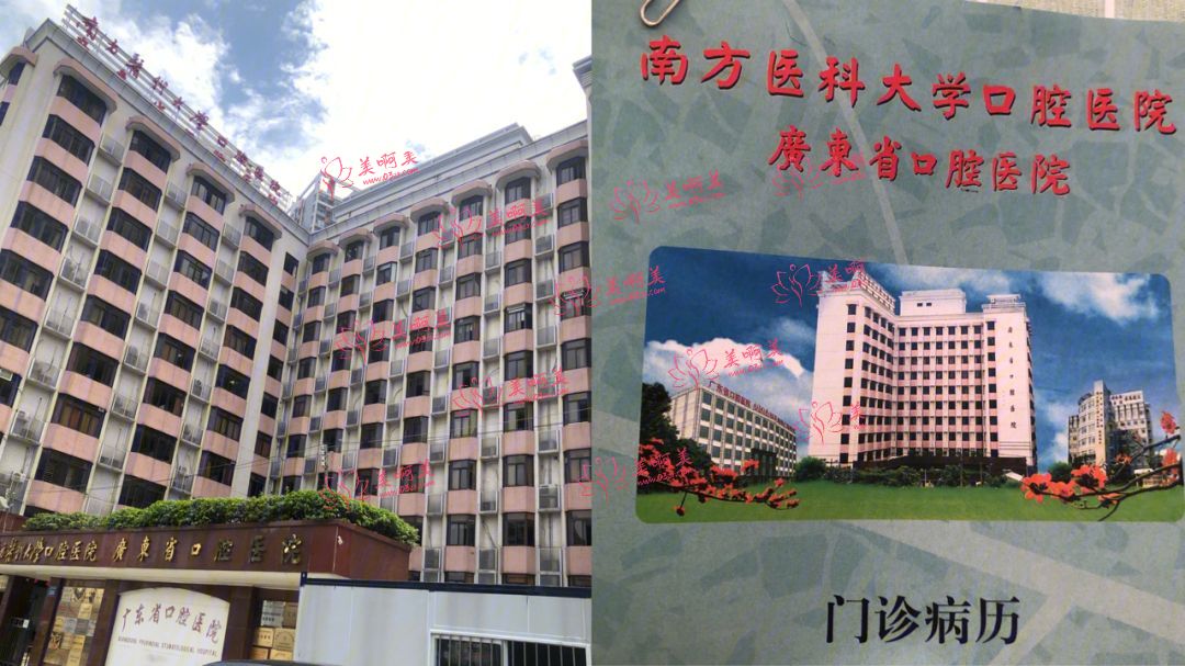 广州口腔医院种植牙、正畸等的收费情况是怎样的？