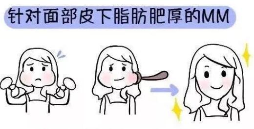 去颊脂垫手术安全吗?影响价格的因素是什么? 去颊脂垫手术安全吗?影响价格的因素是什么?