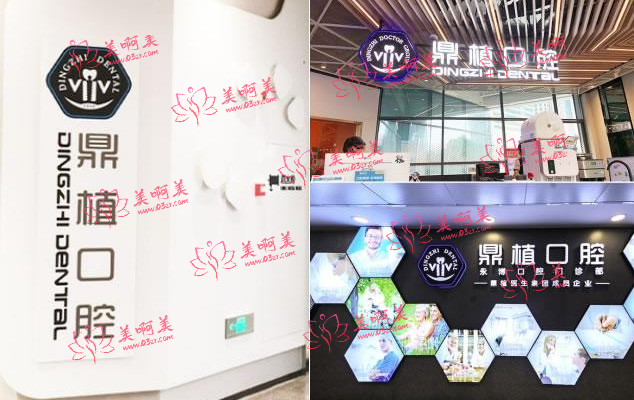 上海宝藏种植牙医院安利——松丰、圣贝、鼎植!便宜技术硬 上海宝藏种植牙医院安利——松丰、圣贝、鼎植!便宜技术硬