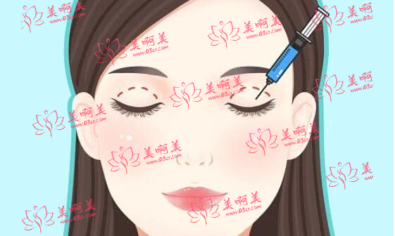 西安美立方做双眼皮贵吗?看看医生技术和案例分享吧! 西安美立方做双眼皮贵吗?看看医生技术和案例分享吧!