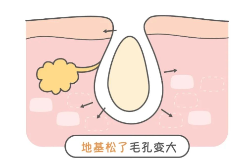 柳州中医医院整形科怎么样?缩毛孔收费贵不贵?附案例分享! 柳州中医医院整形科怎么样?缩毛孔收费贵不贵?附案例分享!