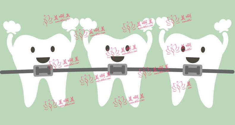 牙齿正畸是要去牙科吗?公立医院好还是去私立医院好? 牙齿正畸是要去牙科吗?公立医院好还是去私立医院好?