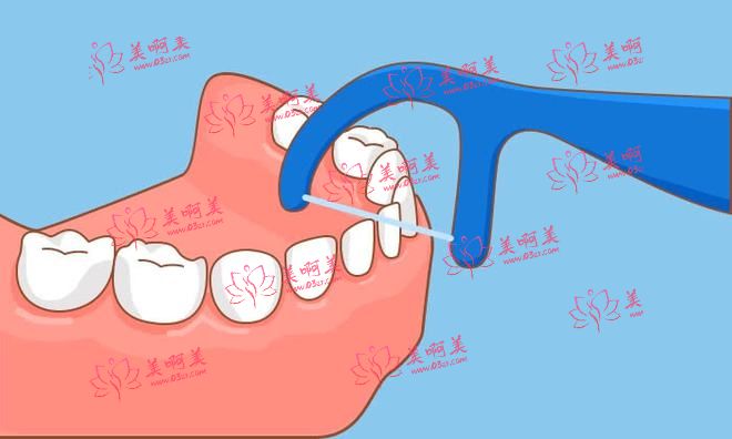 牙齿缝隙大有什么好的方法吗?怎样保持口腔健康? 牙齿缝隙大有什么好的方法吗?怎样保持口腔健康?