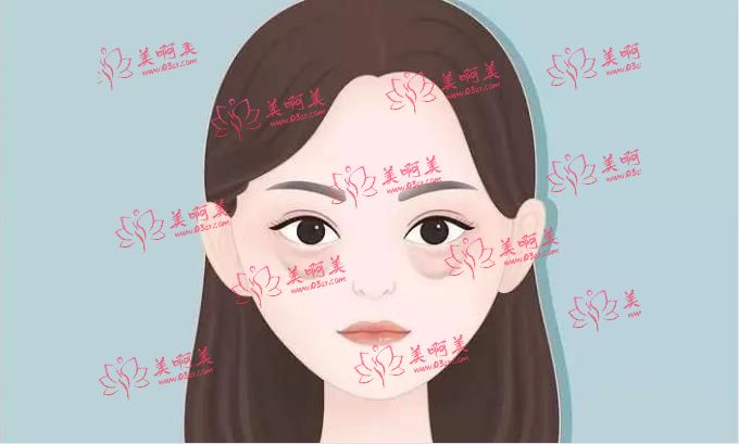 北京八大处王太玲医生去眼袋技术咋样？收费高吗？分享一下整形案例！