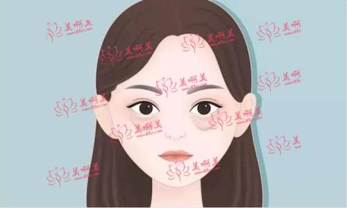 广州健丽医美正规吗?祛眼袋技术怎么样?医生介绍+地址 广州健丽医美正规吗?祛眼袋技术怎么样?医生介绍+地址