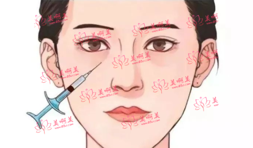 打泪沟嗨体和熊猫针怎么选？来看看多方面对比吧！