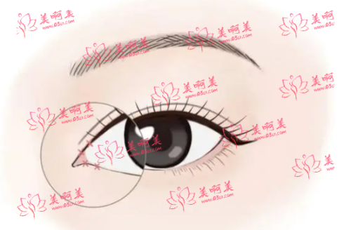 广州南方整形外科怎么样?医生介绍+整形知识科普! 广州南方整形外科怎么样?医生介绍+整形知识科普!