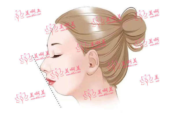 面部不对称(脸歪)怎么矫正?带你全面了解矫正脸型不对称的方法 面部不对称(脸歪)怎么矫正?带你全面了解矫正脸型不对称的方法