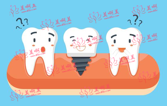 美国种植牙品牌有哪些？来看看品牌介绍+费用详情！