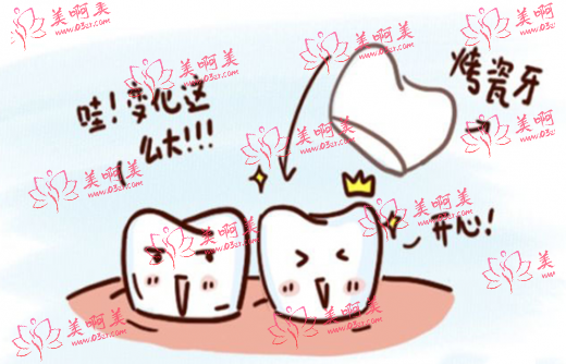 烤瓷牙是怎么收费的？一般600-4000之间！详解烤瓷牙费用成因