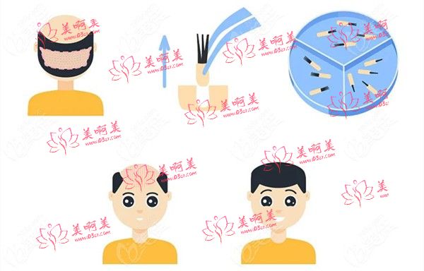 佛山广大医疗美容在哪?植发项目种类展示!网友评价正规疗效好! 佛山广大医疗美容在哪?植发项目种类展示!网友评价正规疗效好!