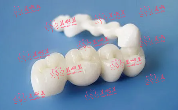 二氧化锆全瓷牙价格表揭秘?寿命多久？优缺点盘点！