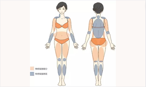 长沙泊丽医疗整形医院怎么样?医疗团队实力强,自体脂肪移植很热门! 长沙泊丽医疗整形医院怎么样?医疗团队实力强,自体脂肪移植很热门!