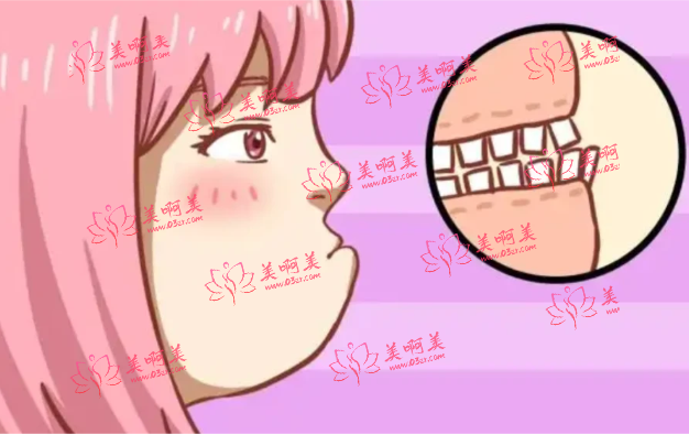 上海九院王国民医生介绍,正颌手术案例分享,看看手术前后对比! 上海九院王国民医生介绍,正颌手术案例分享,看看手术前后对比!