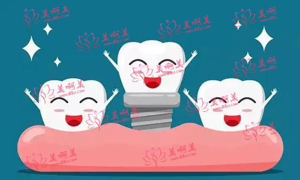 河南省口腔医院种牙贵吗？看看价目收费表吧！种牙活动收费2980一颗！