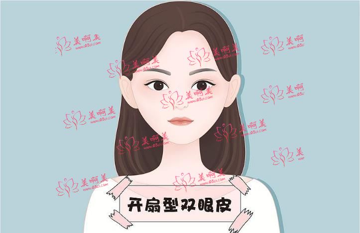 广州莱美美容整形医院双眼皮效果很自然!医生技术很靠谱! 广州莱美美容整形医院双眼皮效果很自然!医生技术很靠谱!