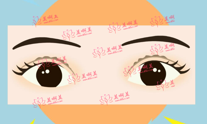  潍坊人民医院靠谱吗？双眼皮技术很靠谱，价格也不贵！