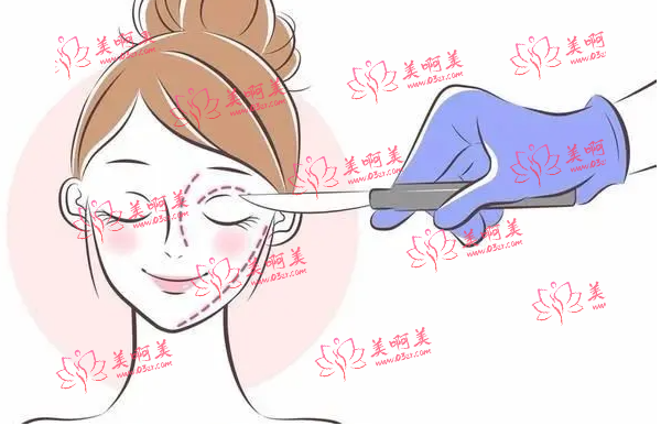 深圳名丽医疗美容医院怎么样？医生实力如何？医院相关资料分享!
