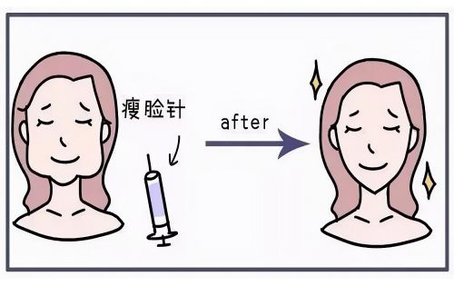 长沙爱思特瘦医疗美容医院怎么样?瘦脸针价格、客户口碑分享! 长沙爱思特瘦医疗美容医院怎么样?瘦脸针价格、客户口碑分享!