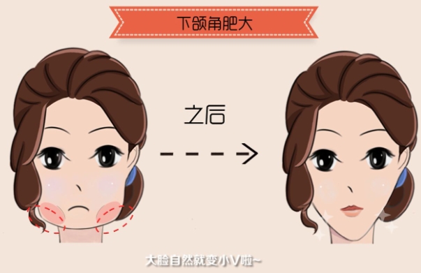 成都东篱医院坐诊医生张立天技术怎么样?擅长项目、技术特色一览! 成都东篱医院坐诊医生张立天技术怎么样?擅长项目、技术特色一览!