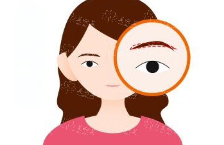 北京华韩医疗美容医院眉毛整形靠谱吗?实力专家名单一览! 北京华韩医疗美容医院眉毛整形靠谱吗?实力专家名单一览!
