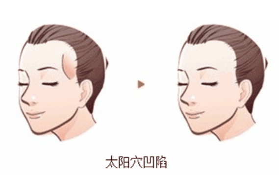 郑州丽天整形医院口碑好吗？经典整形案例分享！