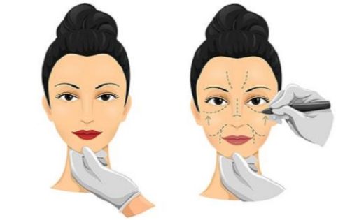 苏州圣爱医院有哪些擅长项目?整形技术在线,口碑还不错! 苏州圣爱医院有哪些擅长项目?整形技术在线,口碑还不错!