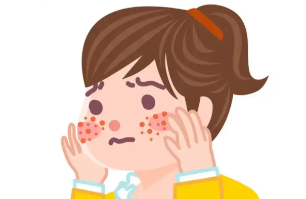 如何有效去除痘印和疤痕中的黑色素沉淀