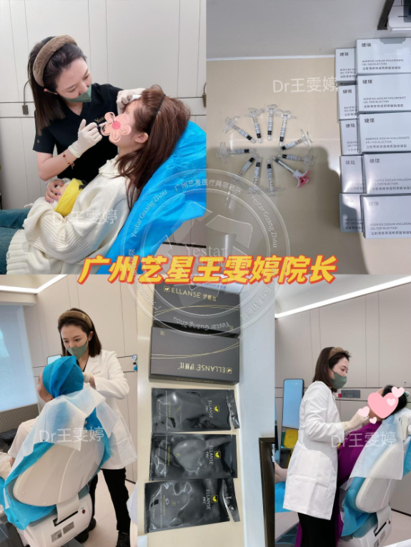 解码防馒化脸美学奥秘,广州艺星王雯婷打造完美年轻面庞 解码防馒化脸美学奥秘,广州艺星王雯婷打造完美年轻面庞