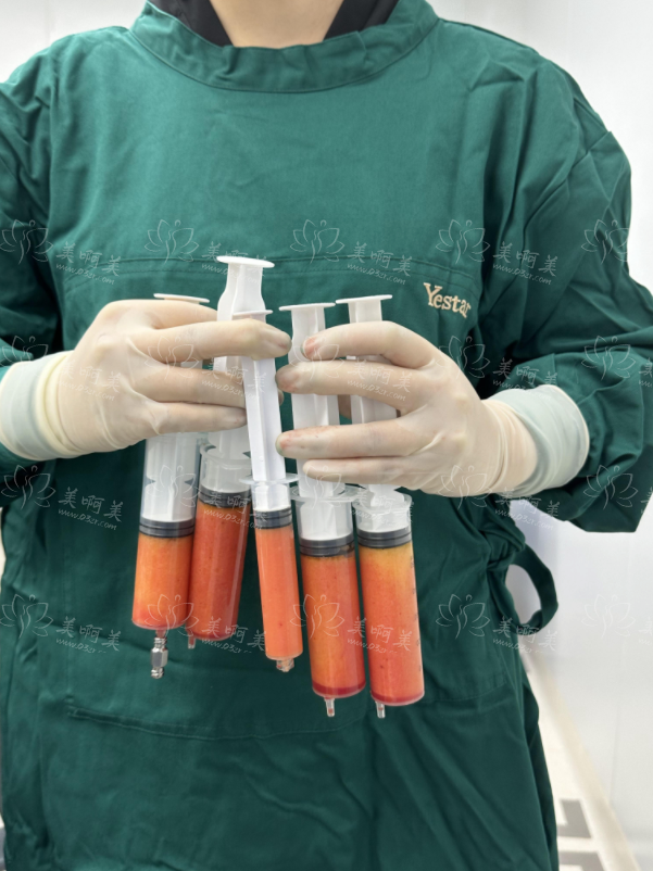 广州艺星邓晟华医生抽脂技术好吗？专业权威带你了解吸脂误区！