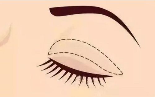 重庆铜雀台整形医院值得信赖吗？医院主打项目分享、常见问题解疑！