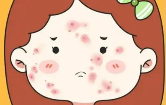 胶原蛋白填痘坑：效果如何?