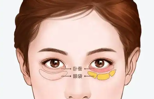 上海六院祛眼袋专家来袭:三位人气医生实力突出! 上海六院祛眼袋专家来袭:三位人气医生实力突出!