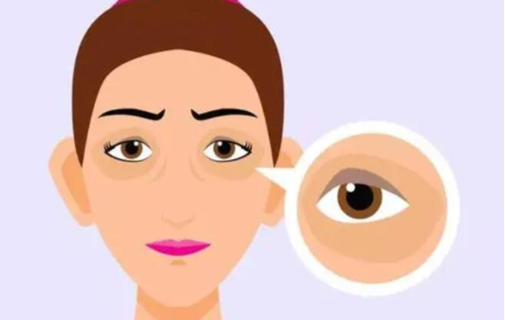 割眼袋技术选哪家好?广州市红十字会医院坐诊医生给出建议! 割眼袋技术选哪家好?广州市红十字会医院坐诊医生给出建议!