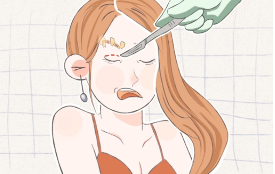 双眼皮手术后疤痕多久才能淡化?一文读懂恢复周期