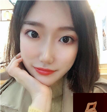 北京纯脂医院2021价格表新版修订发布,内附脂肪填充案例 北京纯脂医院2021价格表新版修订发布,内附脂肪填充案例