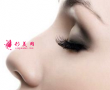 假体隆鼻术后的护理事项有哪些？