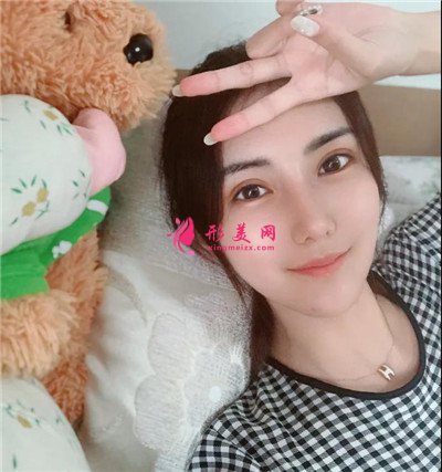 东莞切开双眼皮术后恢复效果反馈 术后 东莞切开双眼皮术后恢复效果反馈