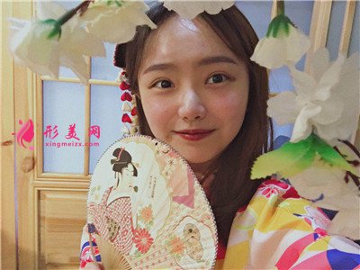 成都小姐姐种植发际线手术术后效果分享 术后 成都小姐姐种植发际线手术术后效果分享