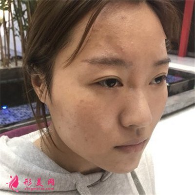 f093ef7bcc50-half.jpg f093ef7bcc50-half.jpg