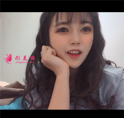 南宁光子嫩肤术后恢复效果对比图分享 术后 南宁光子嫩肤术后恢复效果对比图分享