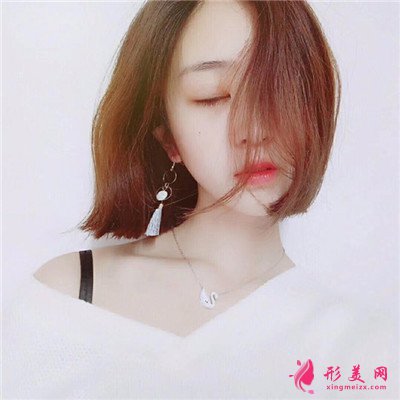 南昌切开双眼皮术后恢复效果展示,小姐姐的模样好标致啊~ 术后 南昌切开双眼皮术后恢复效果展示,小姐姐的模样好标致啊~