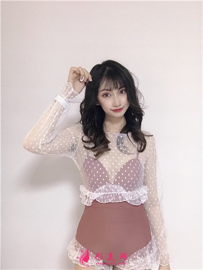 武汉全切双眼皮术后恢复效果展示 术后 武汉全切双眼皮术后恢复效果展示