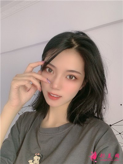 乌鲁木齐眼综合术后案例反馈 术后 乌鲁木齐眼综合术后案例反馈